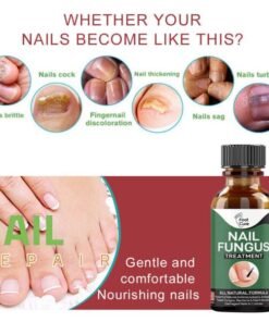 Foot Cure Nail Fungus Solution